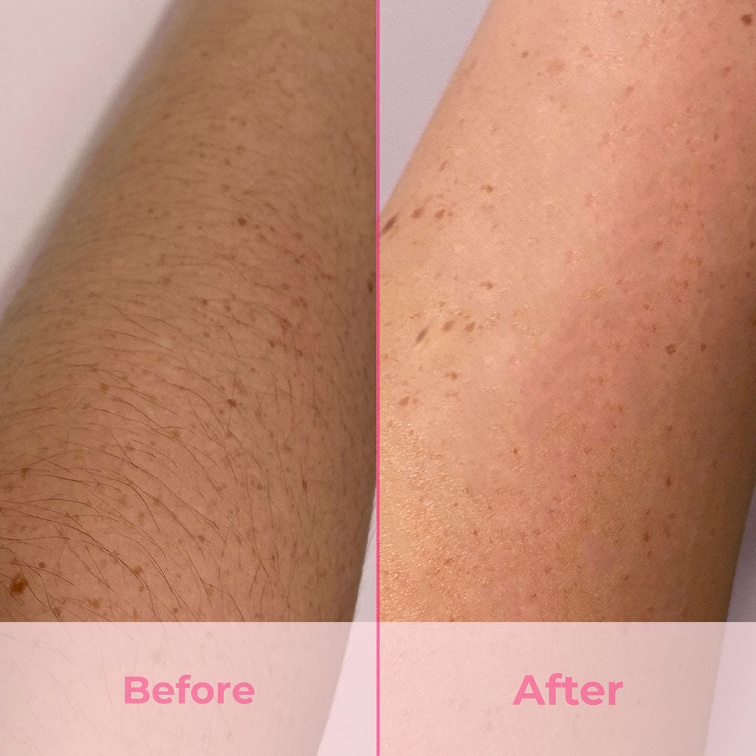 Glowley Hair Removal Handset